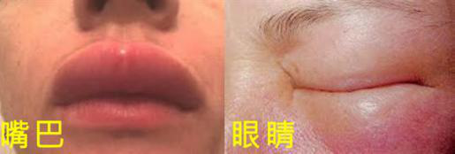 居然有人對冷過敏：這畫面美得不敢看